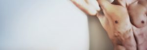 flacidez corporal - Clínica Isturitz | medicina estética – Donostia San Sebastián