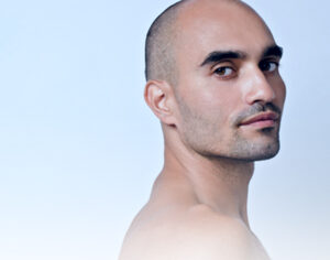 tratamientos especial hombres - Clínica Isturitz | medicina estética – Donostia San Sebastián